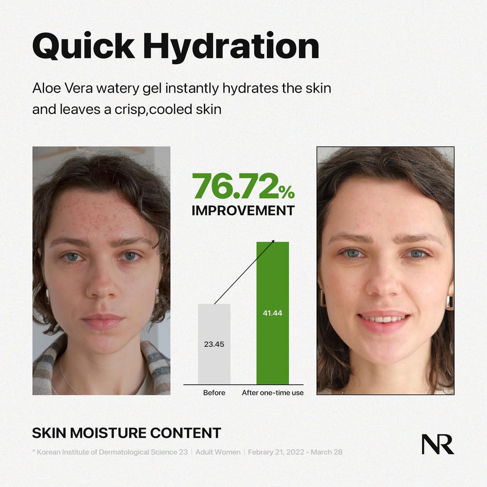 Nature Republic Aloe Vera Gel after-sun cooling—refreshing and hydrating.