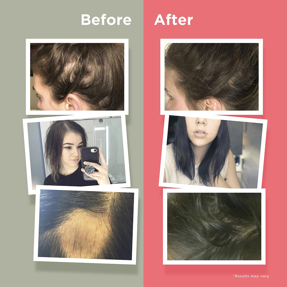 Naturenetics HairAnew charity proceeds graphic communicates charitable support