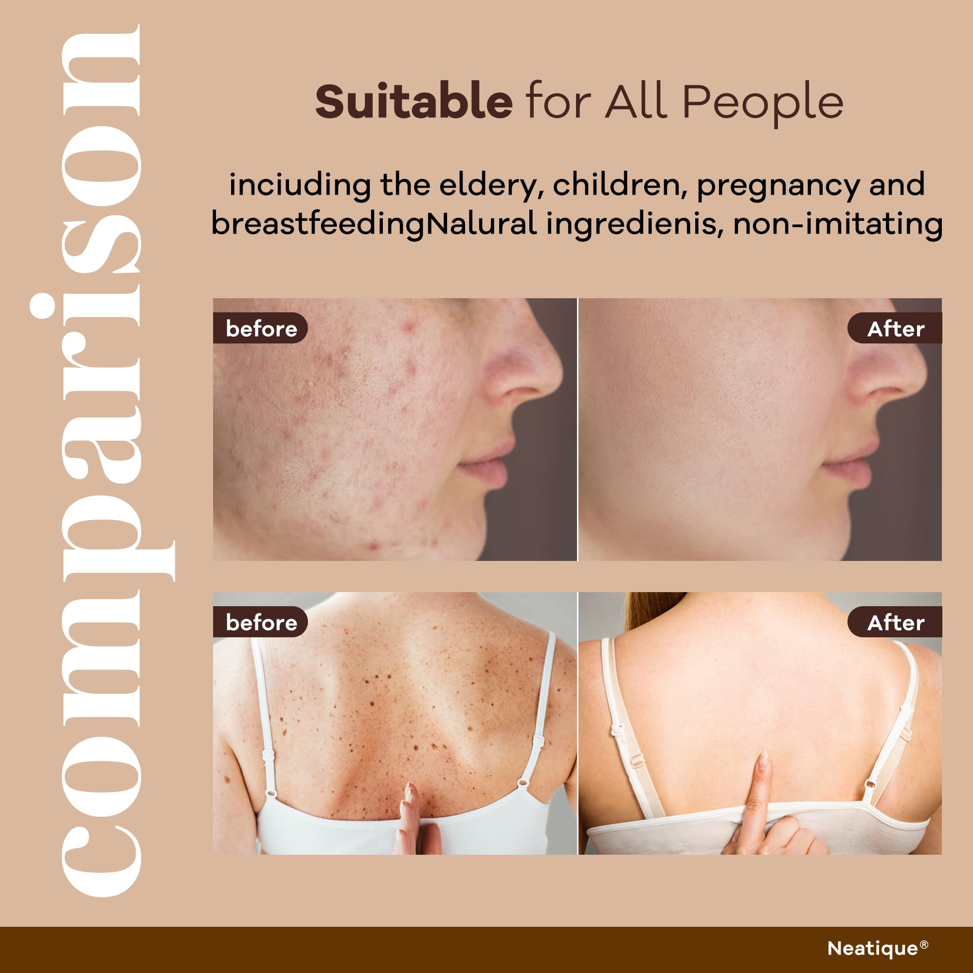 Neatique dermatologist-tested icon indicating gentle protection for sensitive or reactive skin.