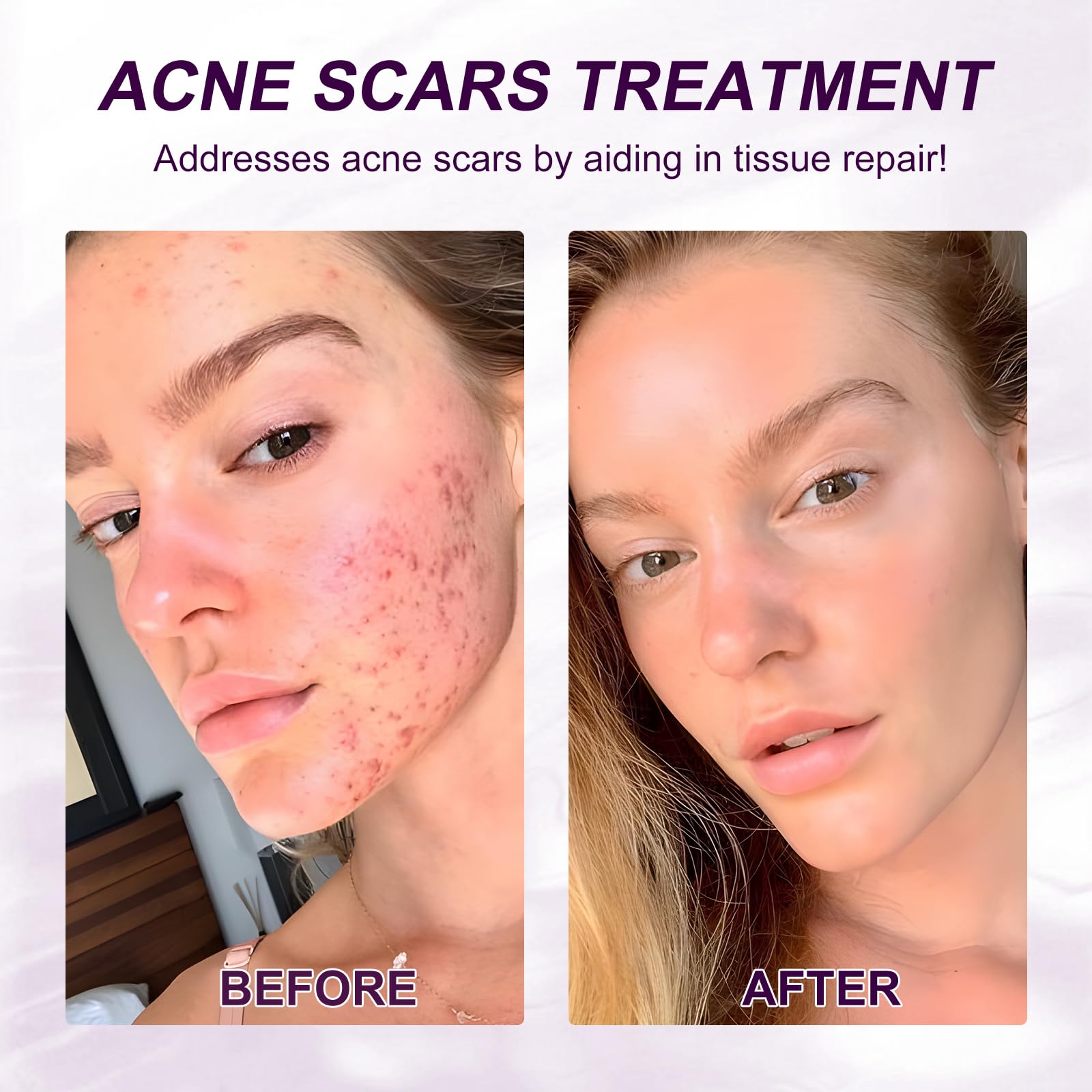 Netwik Azelaic Acid Serum ingredients panel featuring aloe and vitamins