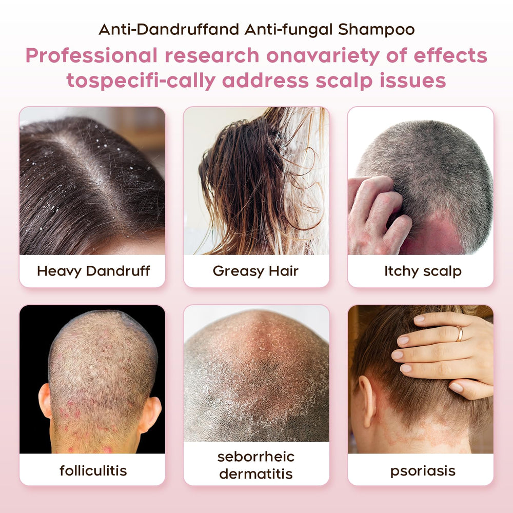 NEWREY application rub scalp shows targeted relief during wash
