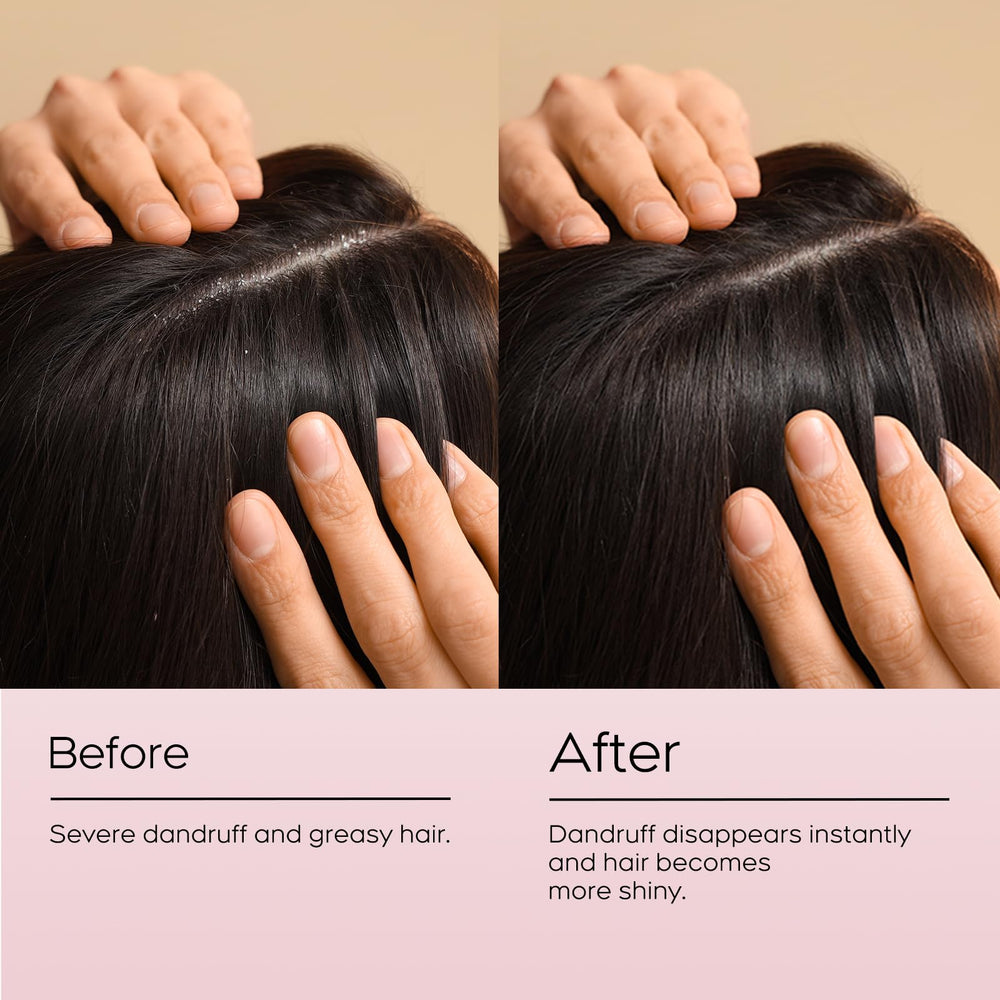 NEWREY herbal-enriched ingredients highlight Sophora flavescens benefits for scalp balance