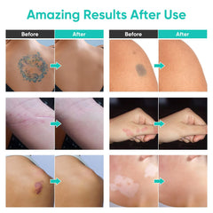 NHZ Tattoo Cover Up Makeup delivers a seamless finish on visible skin