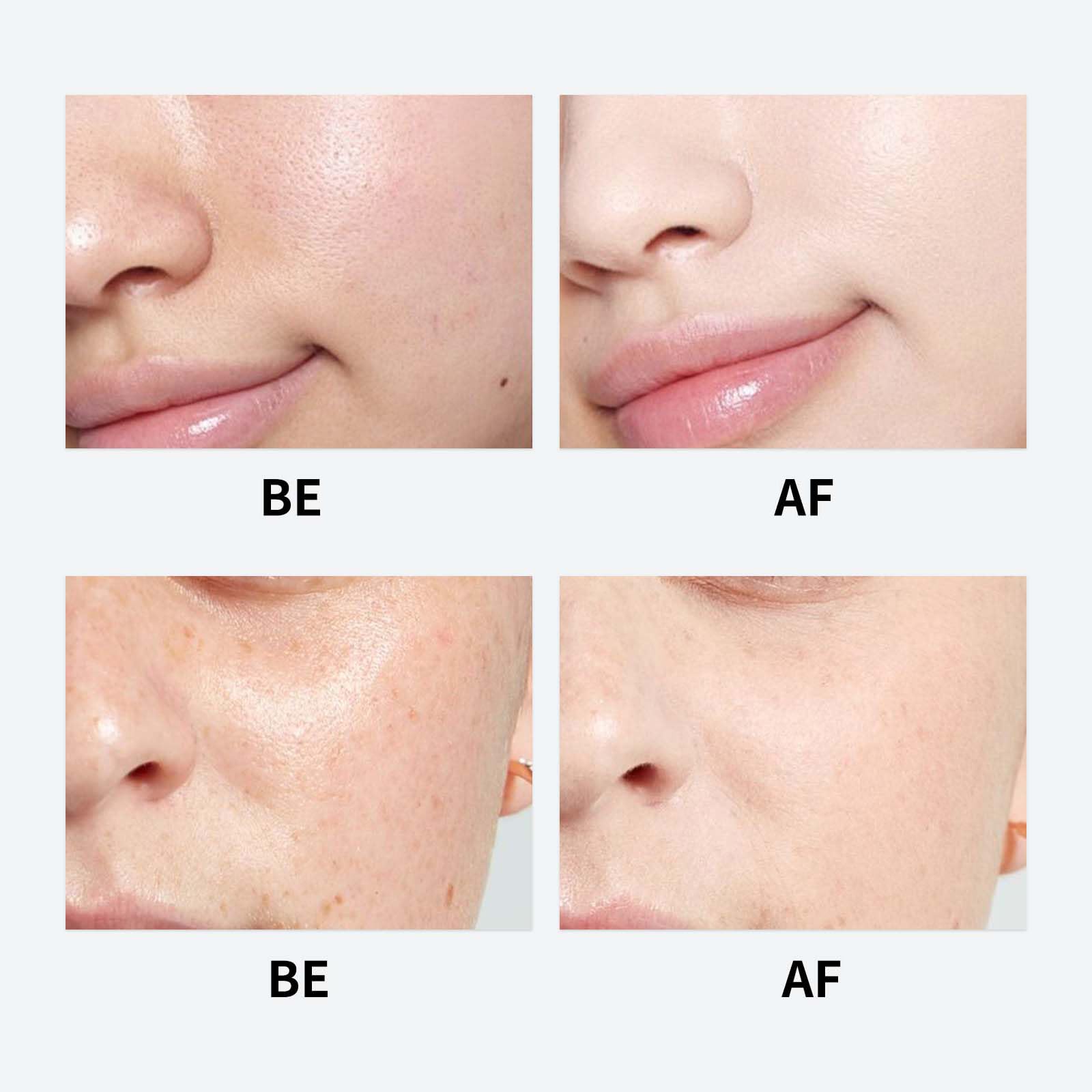 Nida Centella moisturizer soothes skin with gentle, calming hydration.