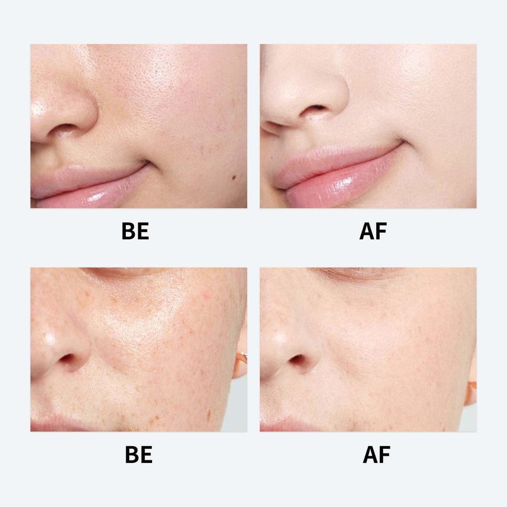 Nida Centella moisturizer soothes skin with gentle, calming hydration.