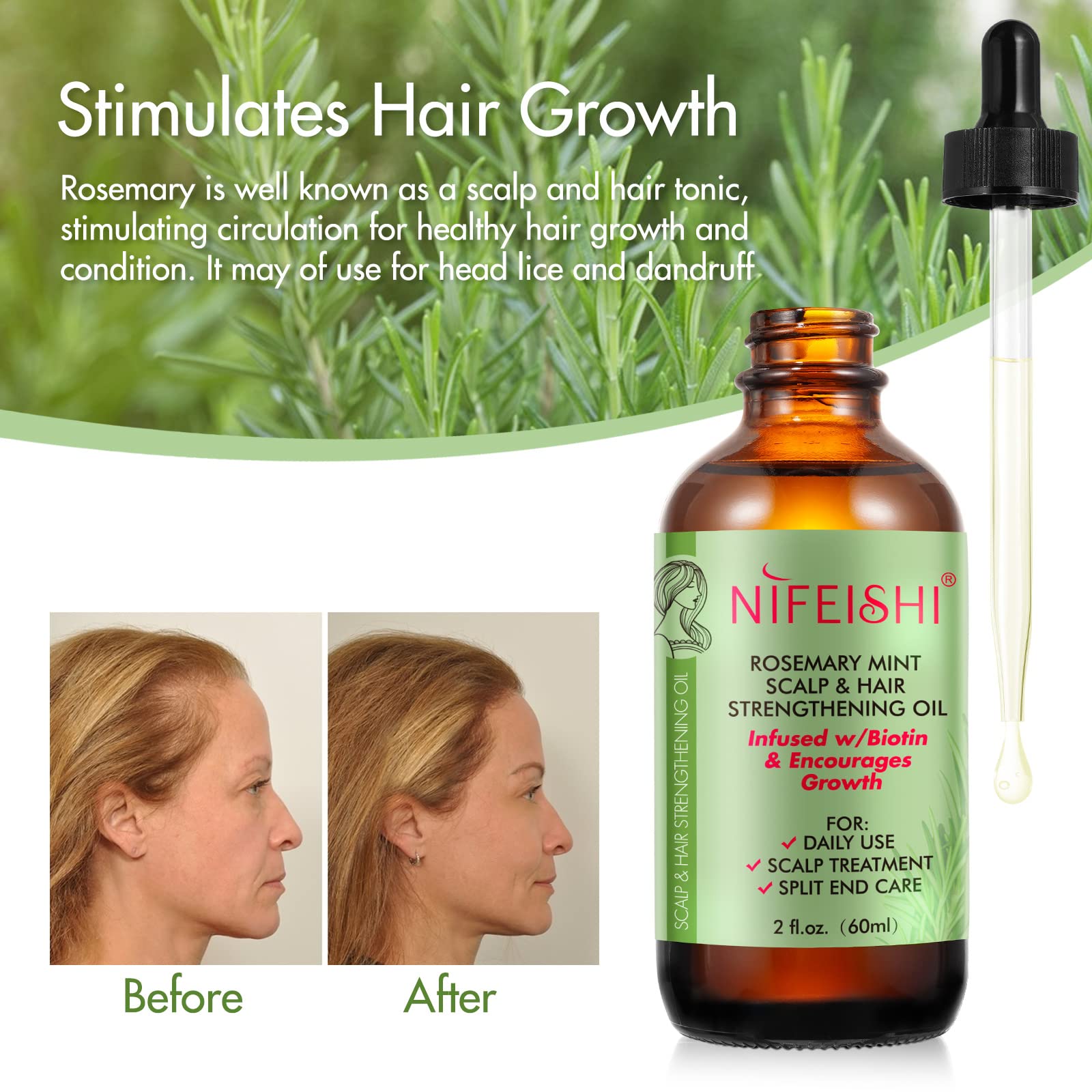 NIFEISHI rosemary oil mint-infused bottle highlights invigorating scalp refresh and deep conditioning