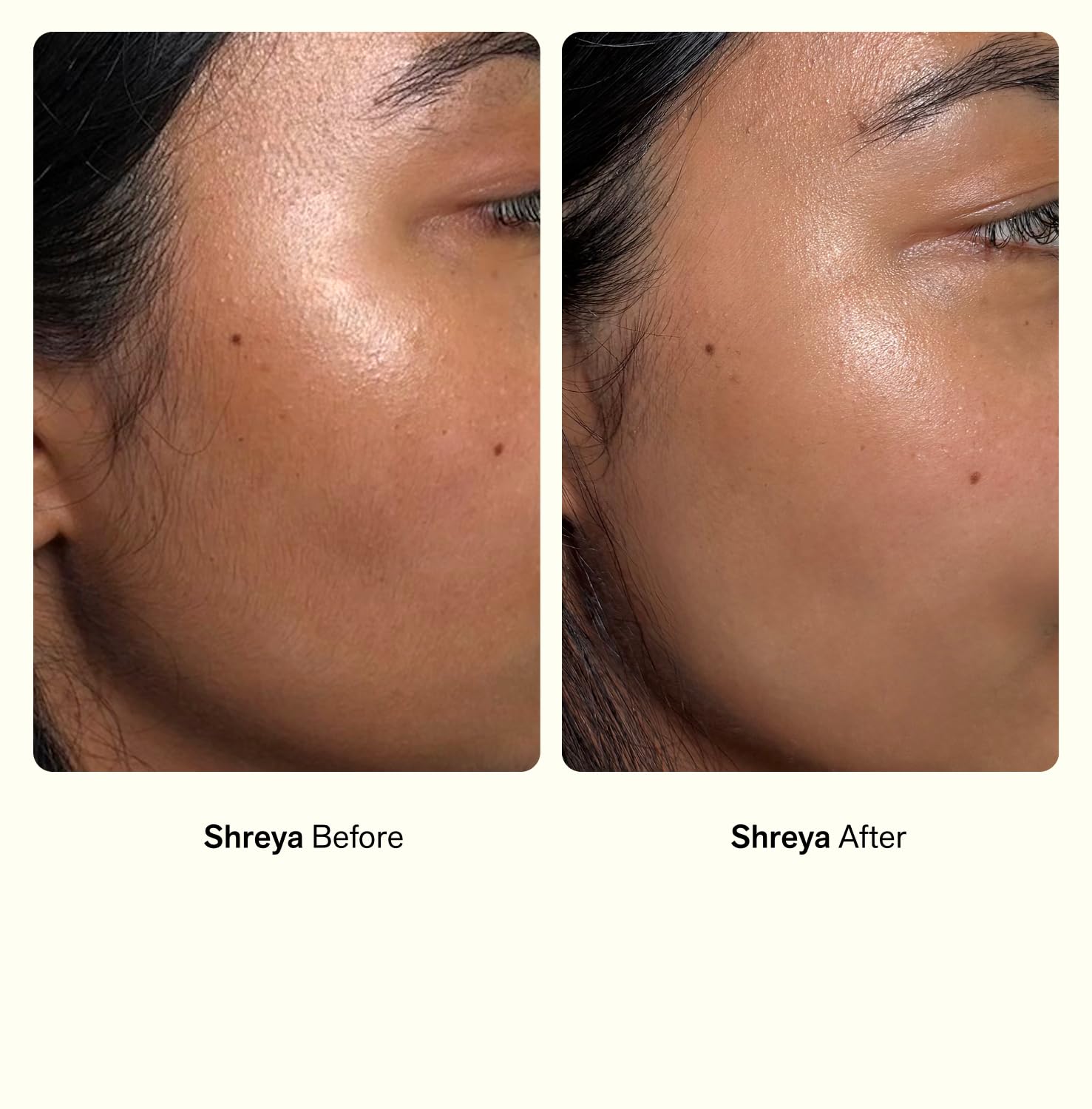 Nimbi Dermaplaner Razor safe for all skin types, including sensitive skin.