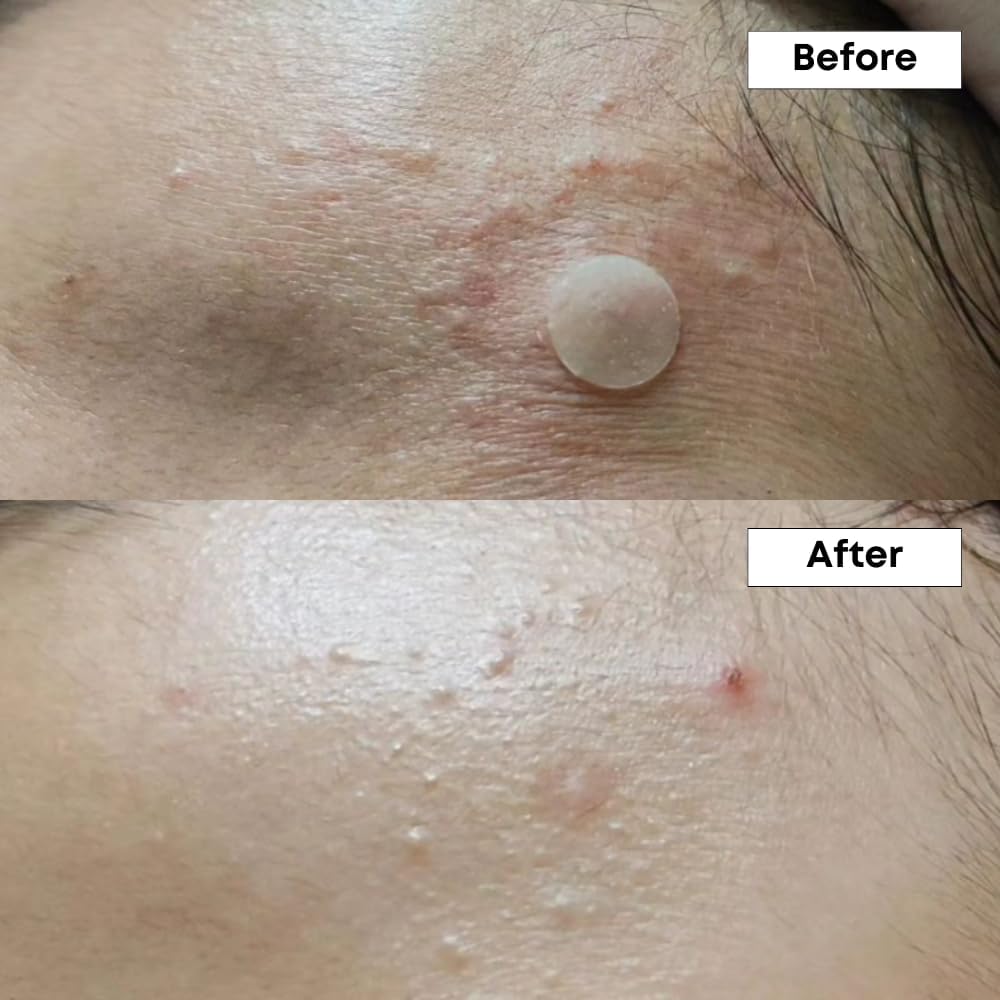 NINELESS A-Control oil-balance close-up; helps regulate sebum for balanced skin.