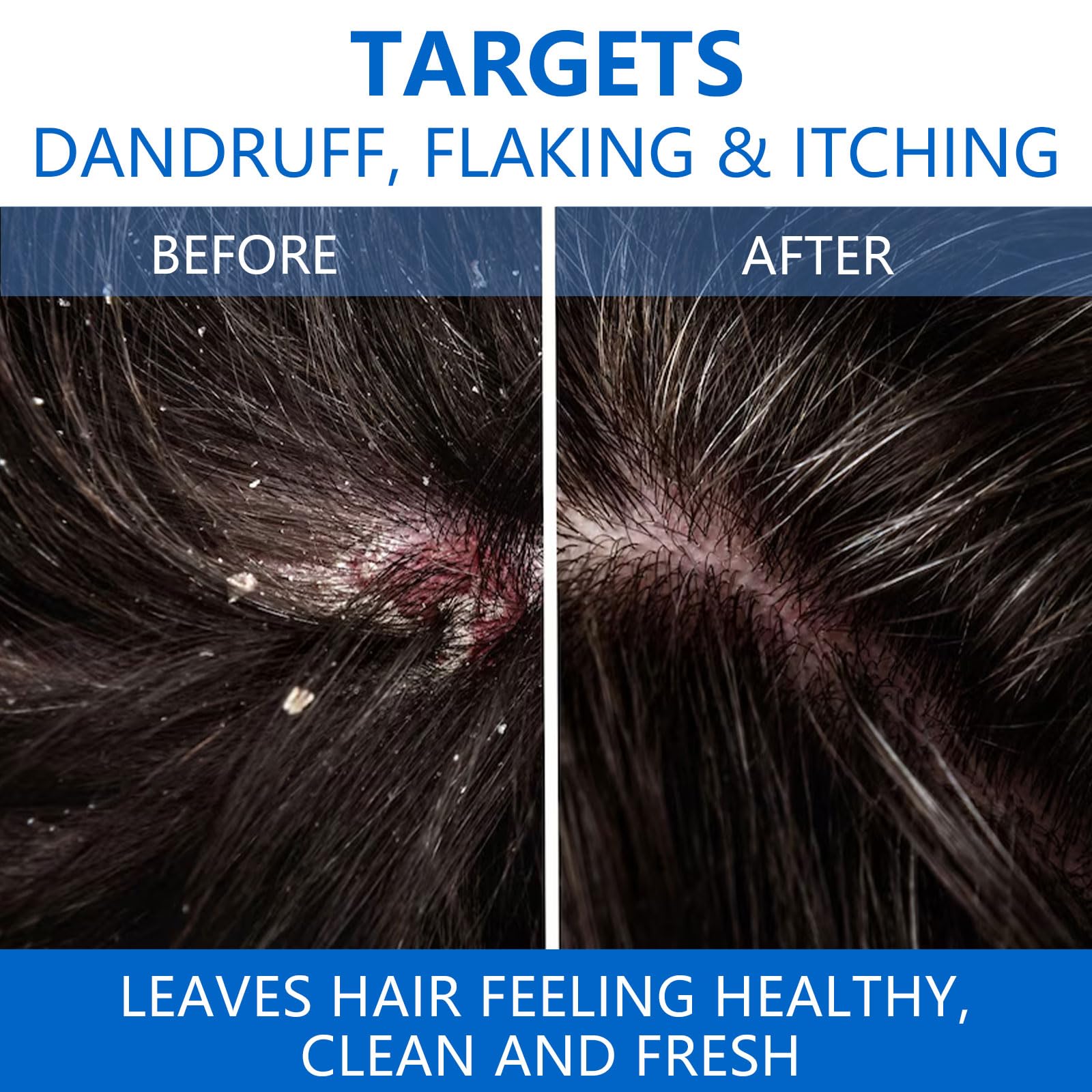 NIPPORI shampoo scalp closeup shows soothing formula promoting comfortable, refreshed feel.