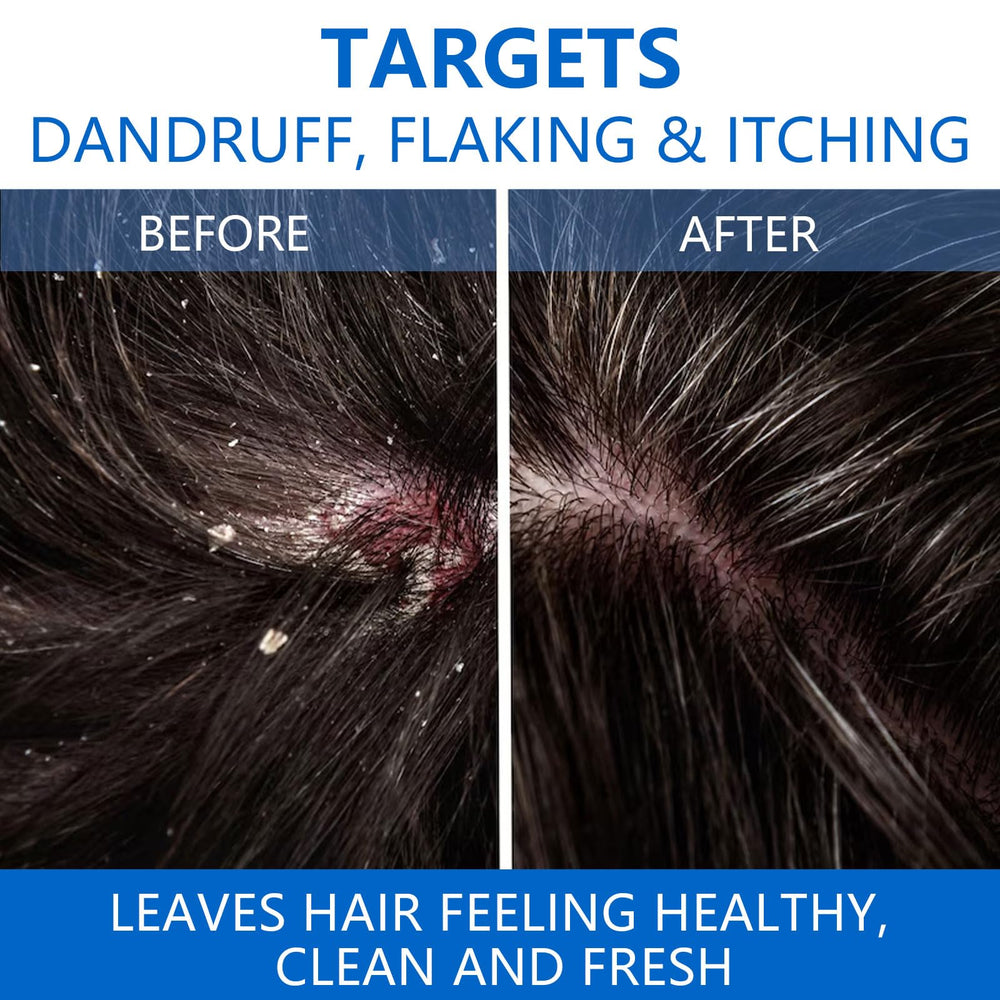 NIPPORI shampoo scalp closeup shows soothing formula promoting comfortable, refreshed feel.