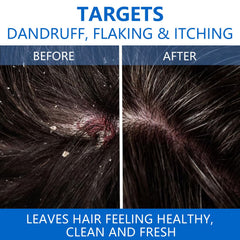 NIPPORI shampoo scalp closeup shows soothing formula promoting comfortable, refreshed feel.