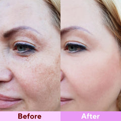 Nityrliv Bio-Collagen mask on face demonstrating snug fit