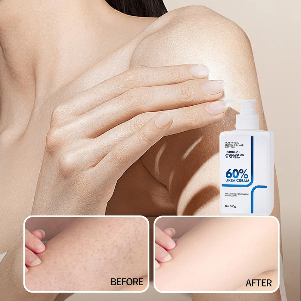 NIZENTA Urea Cream gift packaging idea for thoughtful self-care.