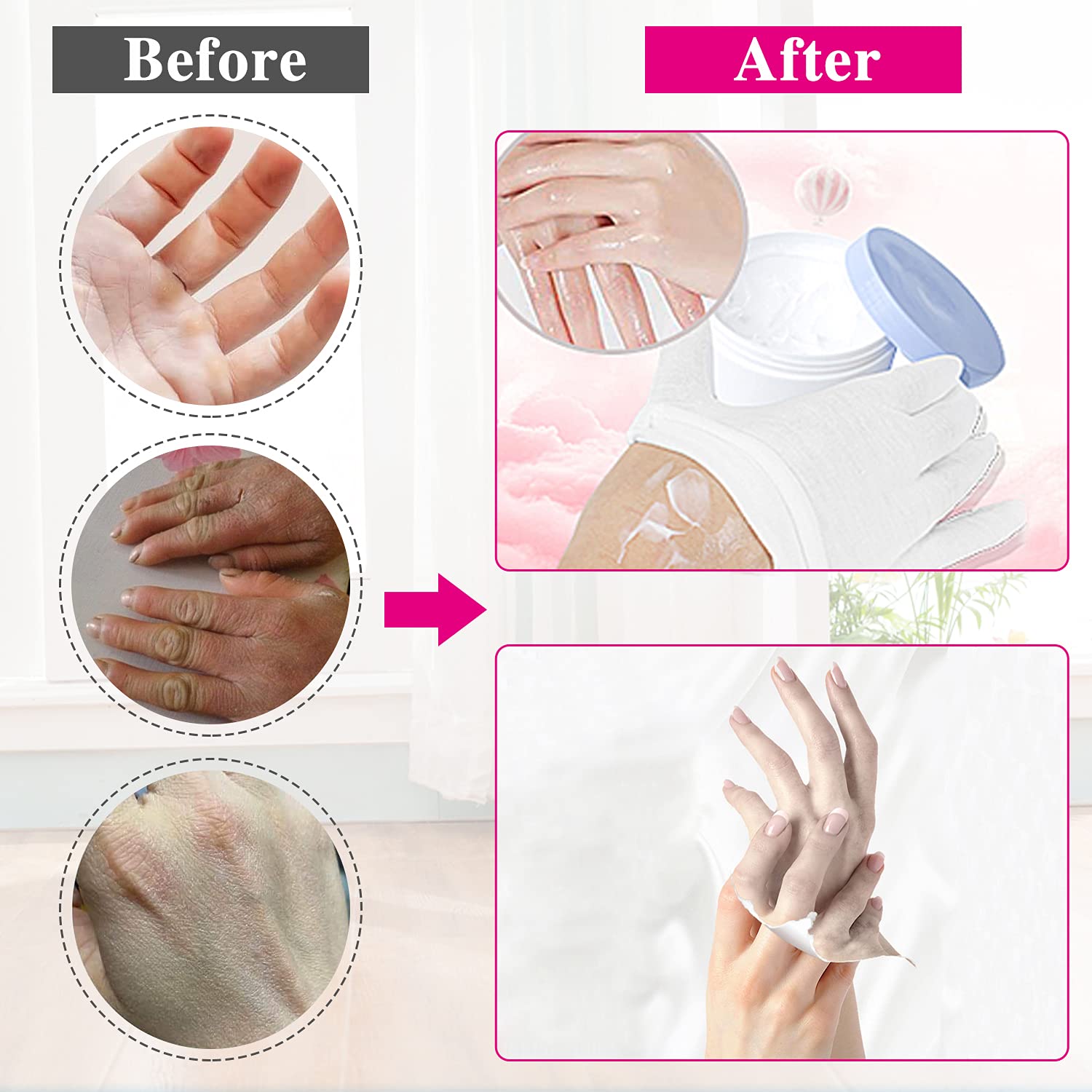 NJDGF night-use white cotton gloves help moisture retention during rest.