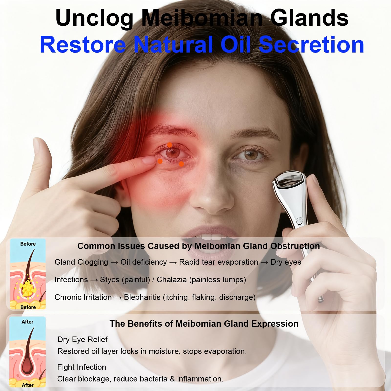 NKQ Meibomian gland massage compact design enables on-the-go eyelid care