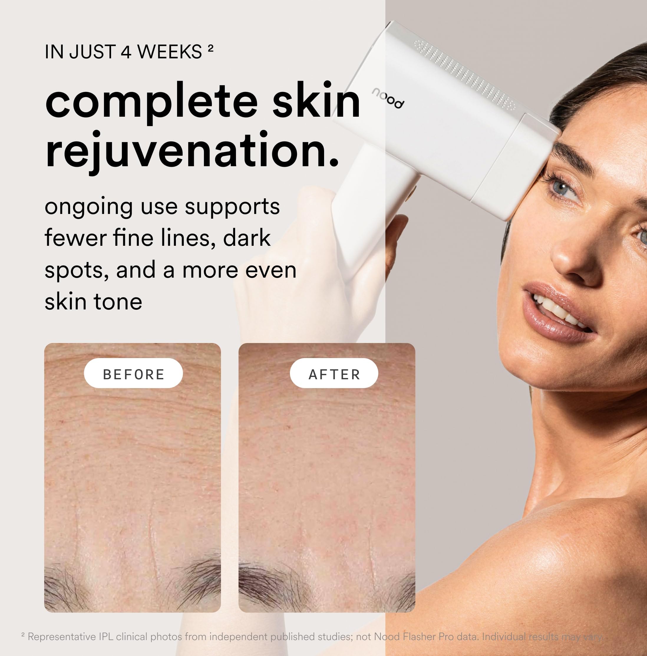 Nood Flasher Pro anti-aging lens swap targets fine lines and pores for refined skin.