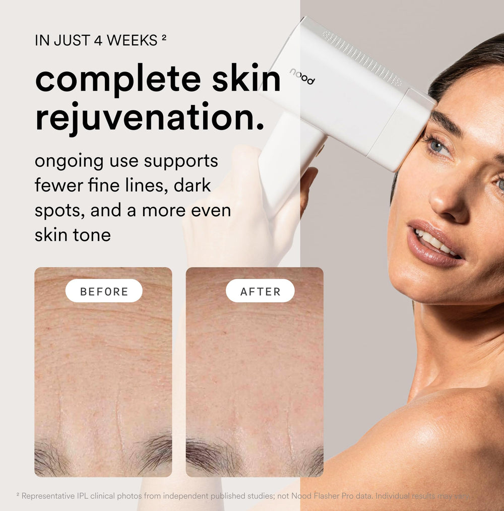 Nood Flasher Pro CryoSoothe cooling technology cools skin during sessions.
