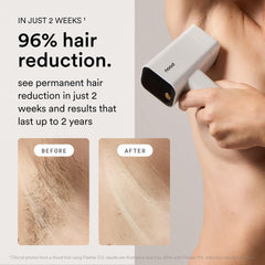 Nood Flasher Pro CryoSoothe system close-up highlights skin-safe, cool treatment during flashes.