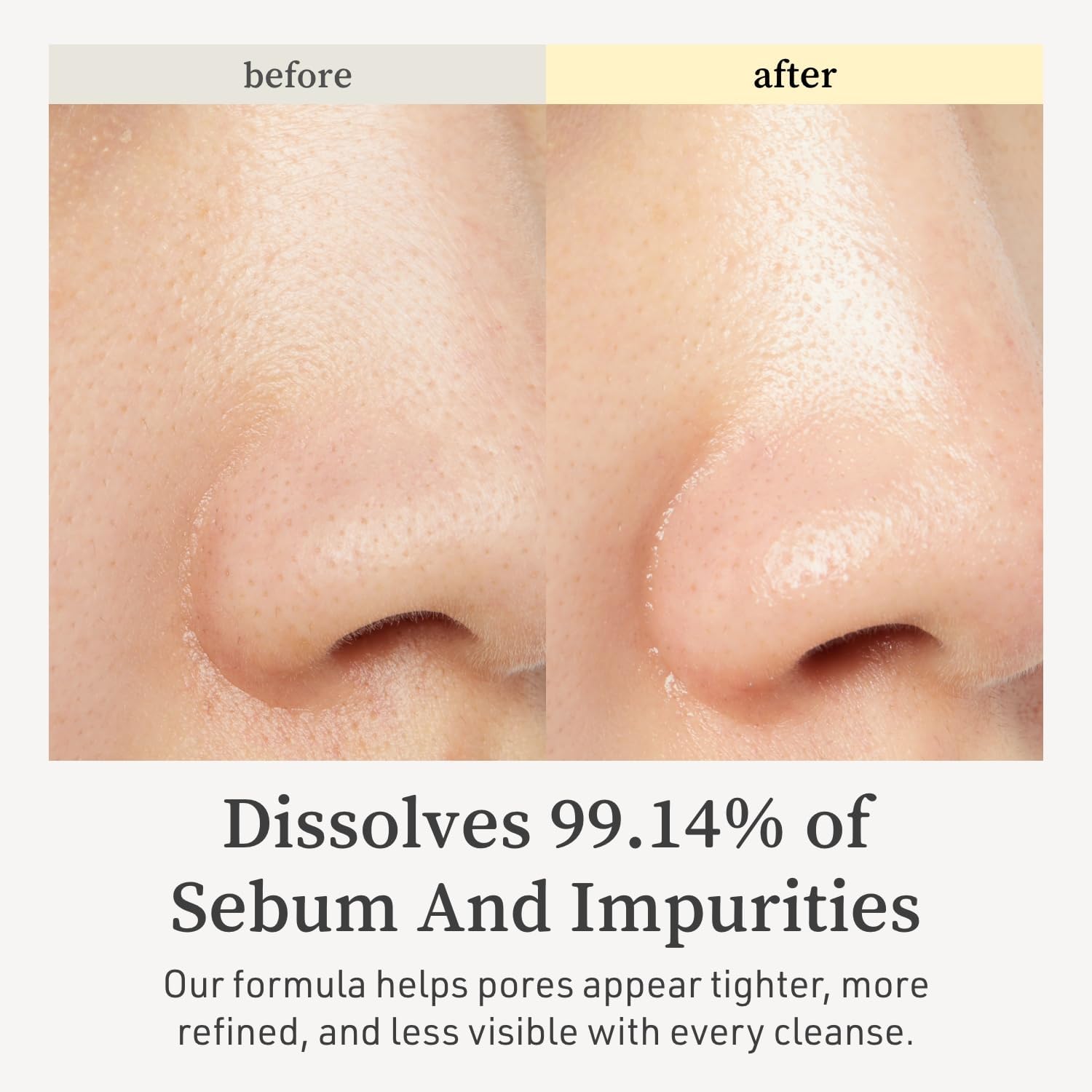 NOONI Snow Aqua closeup reveals egg-skin texture and radiant complexion potential.