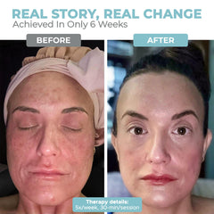 Nourished Bodynskin LED mask decolletage coverage targets neckline area for balanced tone.