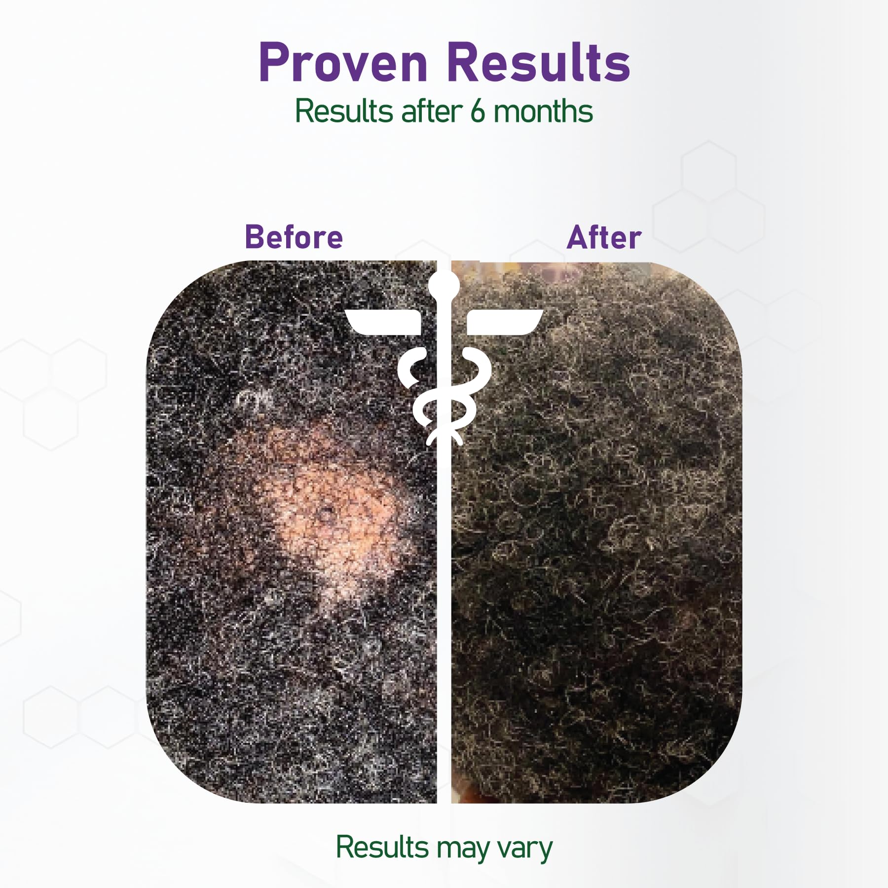 NouriTress Perfect Hair Vitamins Plus box with pills aligns with daily routine.