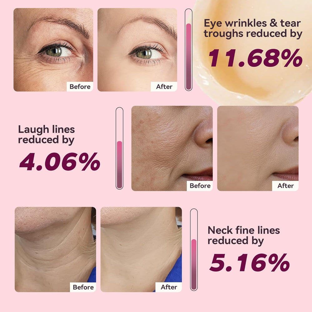 nuckhuce calcium volume multi balm stick close-up with shea butter hydration.
