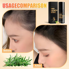 Nuckhuce Hair Growth Spray on scalp supports thinning hair and fullness.