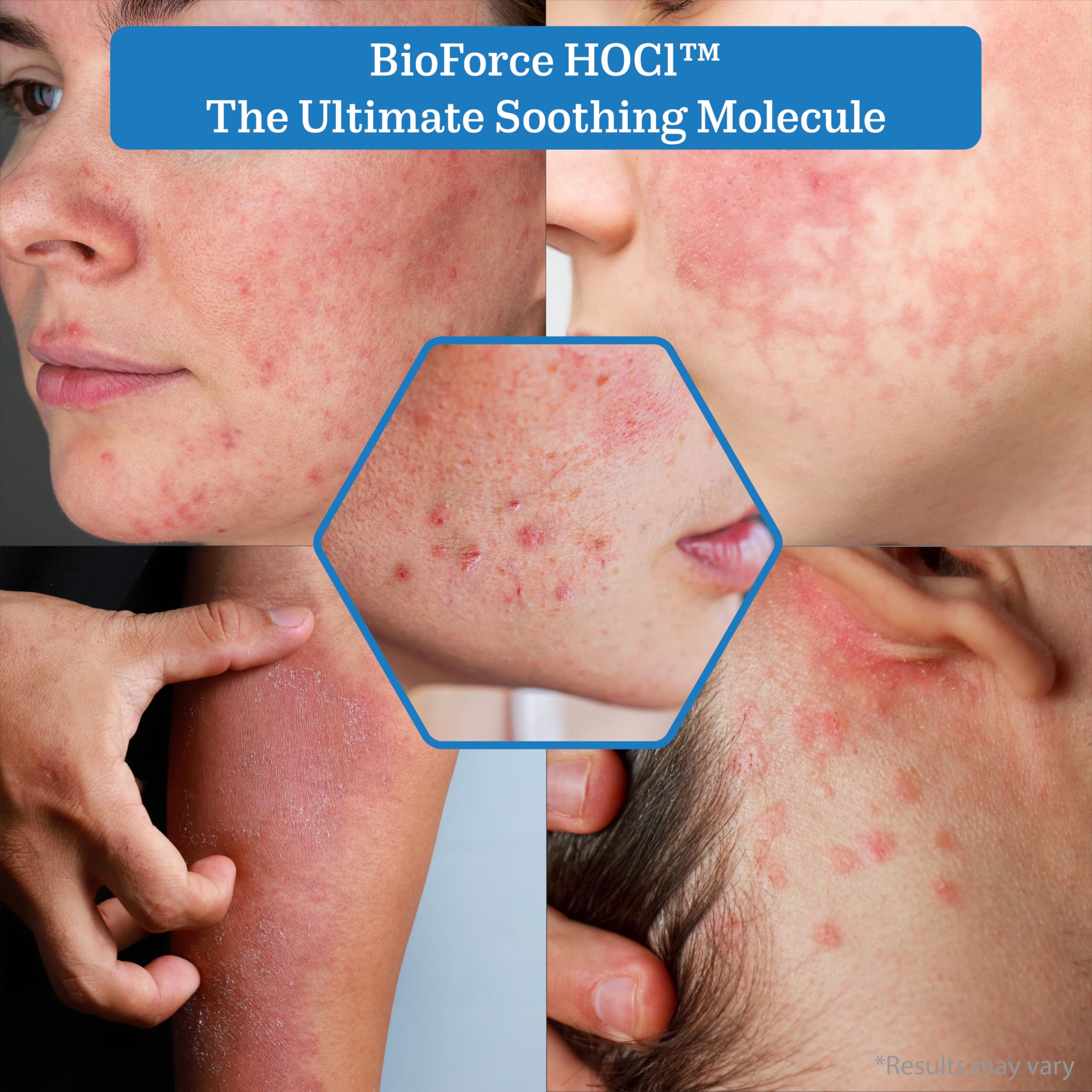 NueVue BioForce HOCl spray 360-mist coverage in action