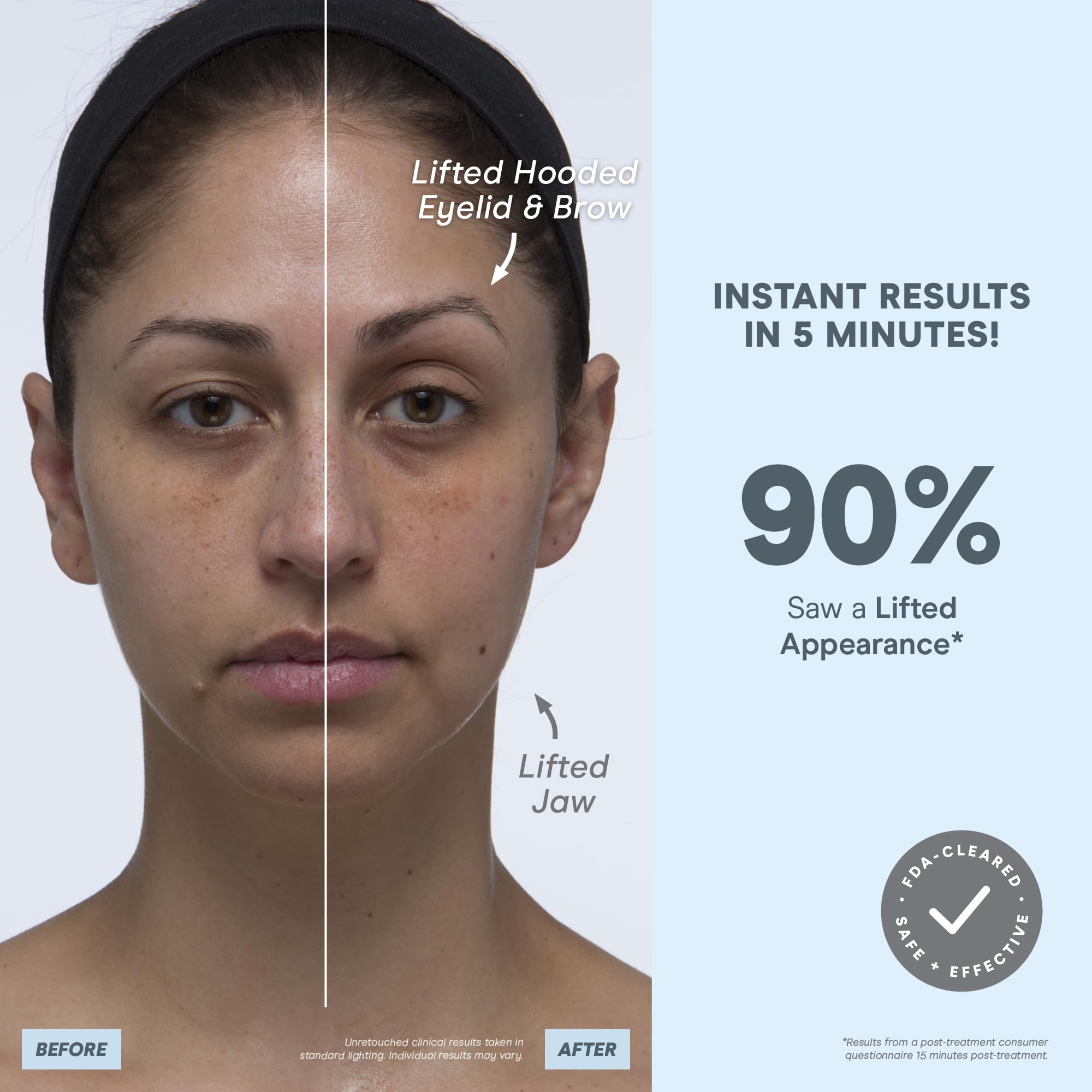 NuFACE MINI+ device used along jawline for defined facial contours.