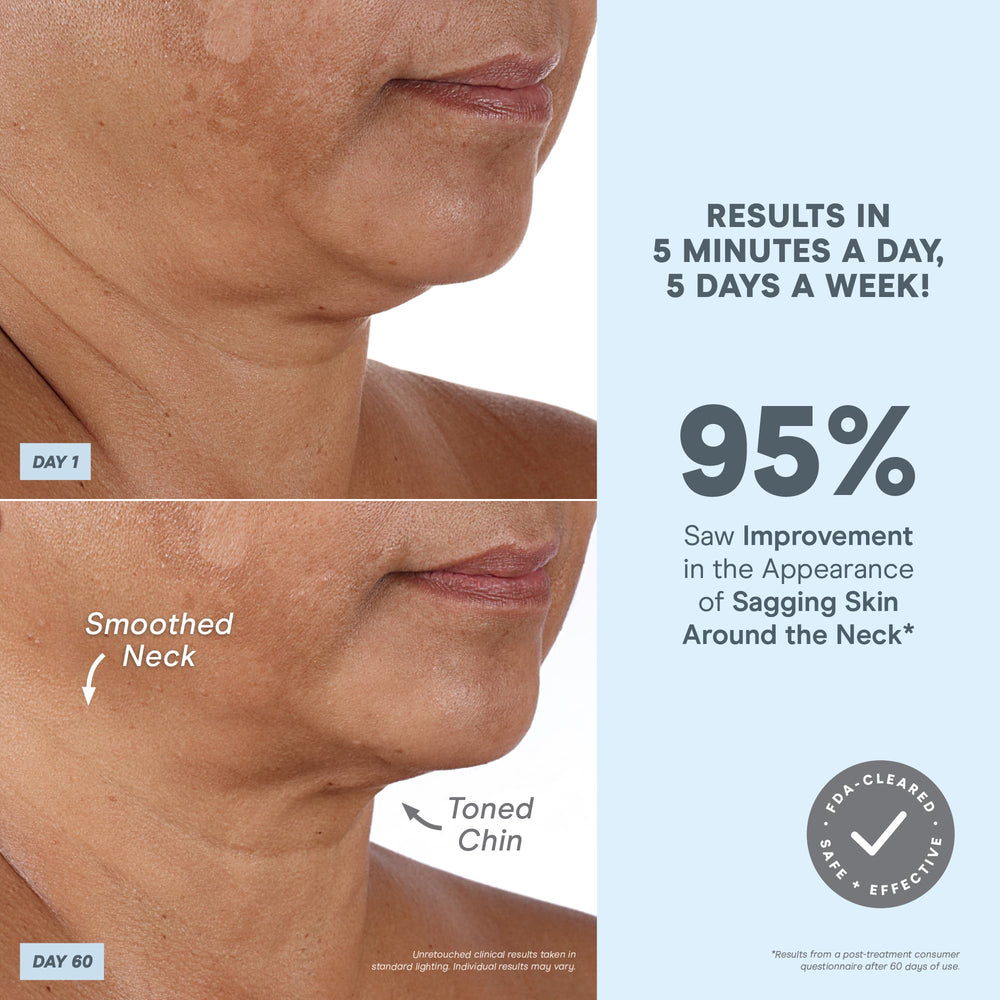 NuFACE MINI+ results montage showing lifted skin and elevated brows.