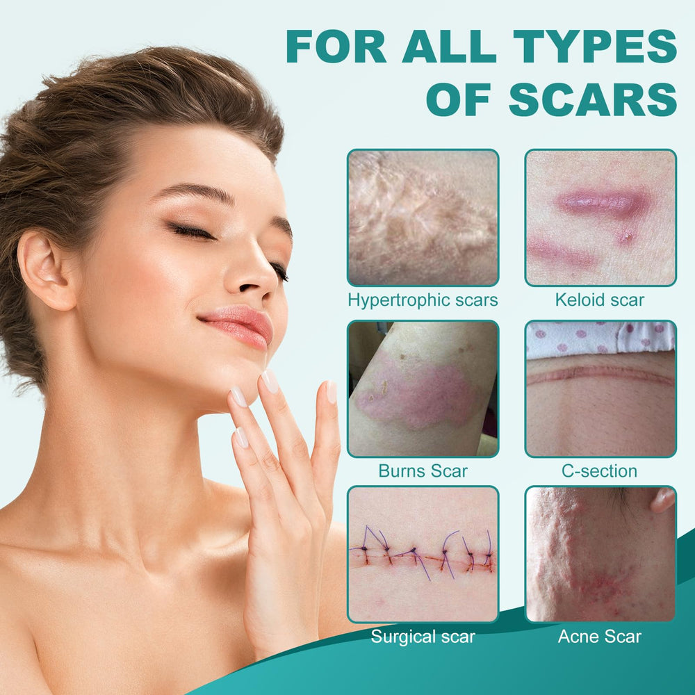Nullam silicone scar sheets cut to size demonstrates customizable fit for various scars