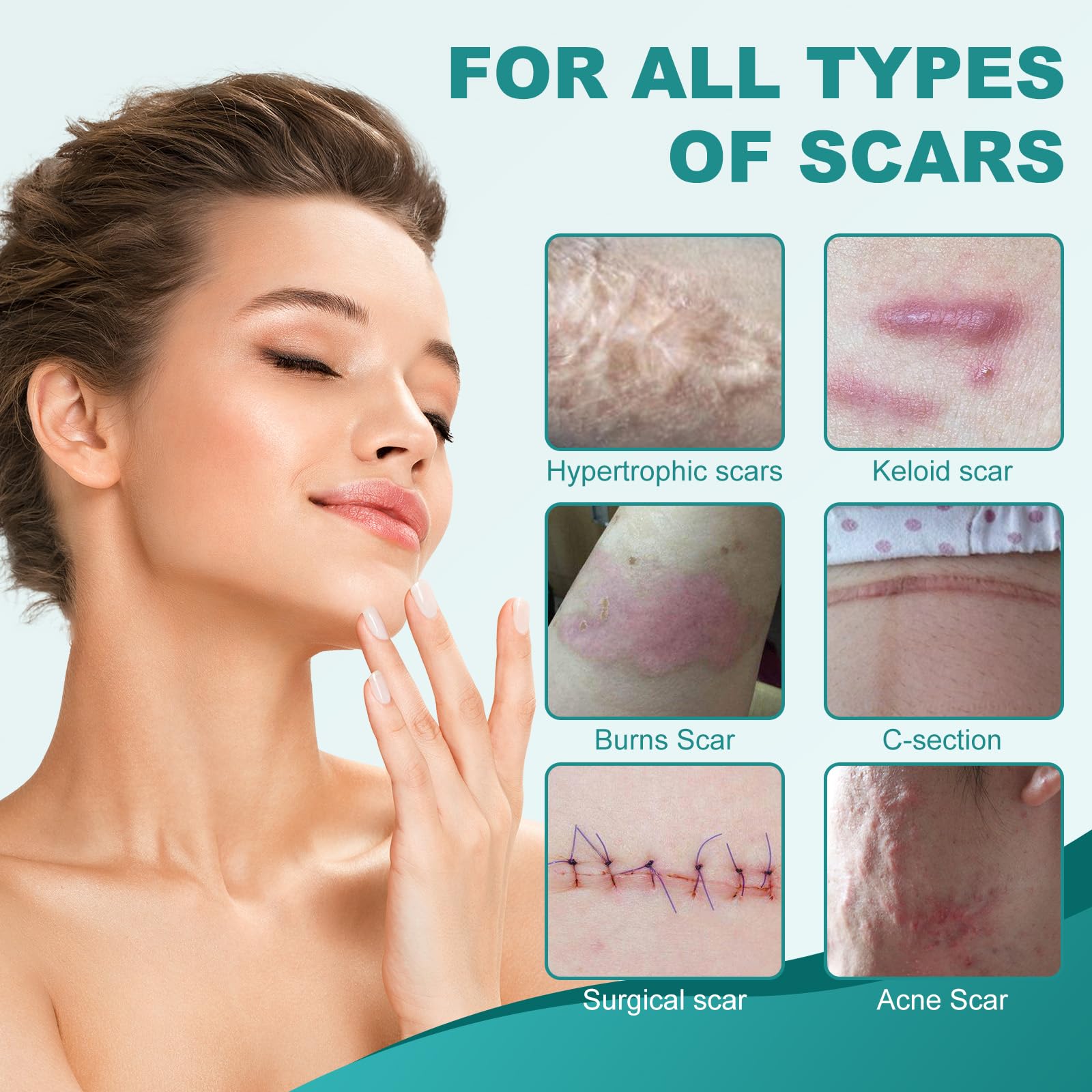 Nullam silicone scar sheets fabric texture demonstrating flexible, nearly invisible coverage