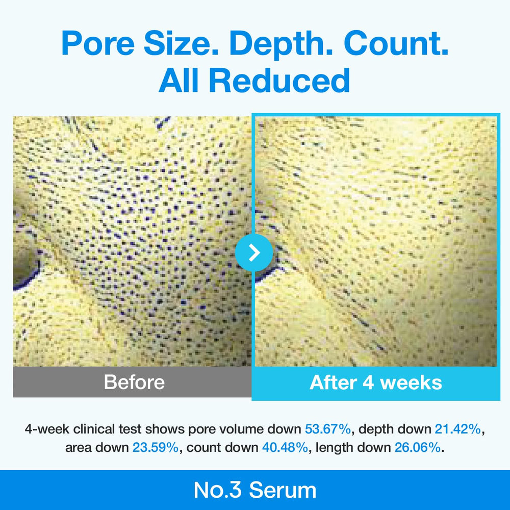 numbuzin No.3 niacinamide close-up suggests texture refinement benefits