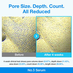 numbuzin No.3 niacinamide close-up suggests texture refinement benefits