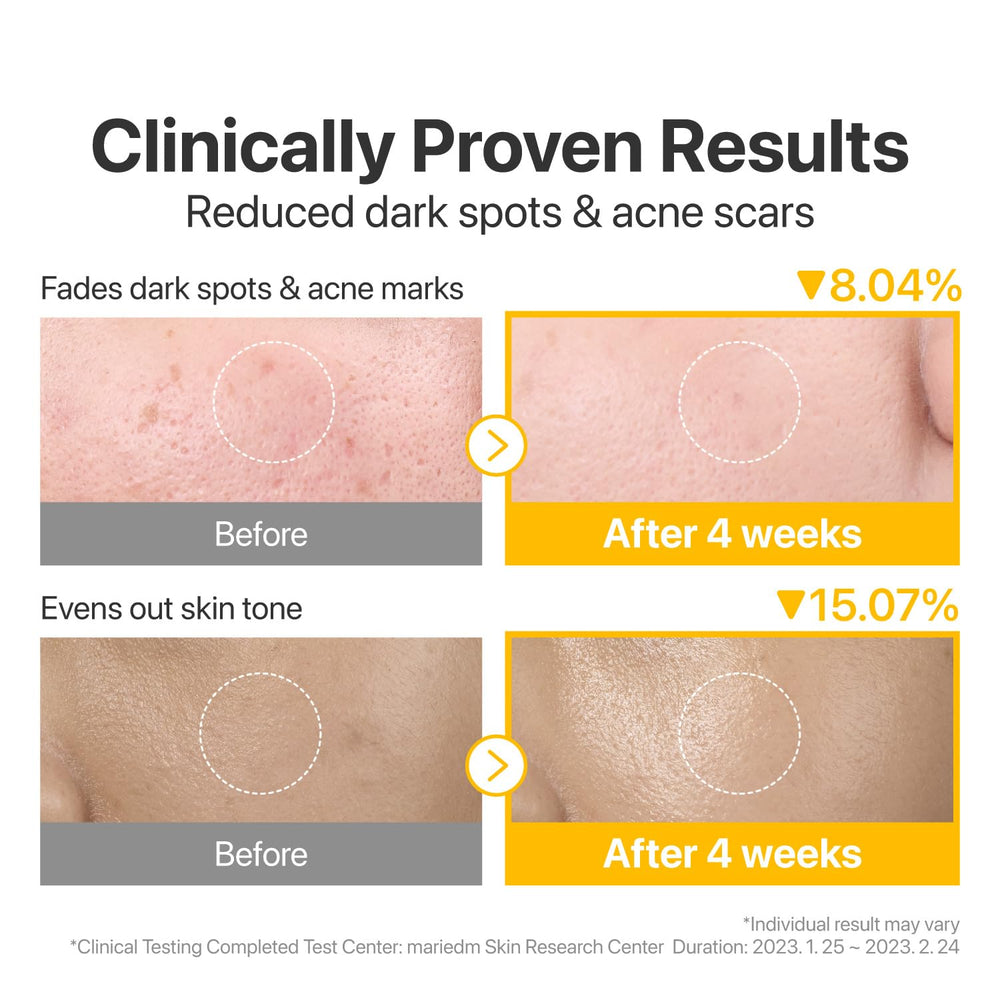 Numbuzin No5 essence-packed pad with glutathione and niacinamide for post-cleanse care