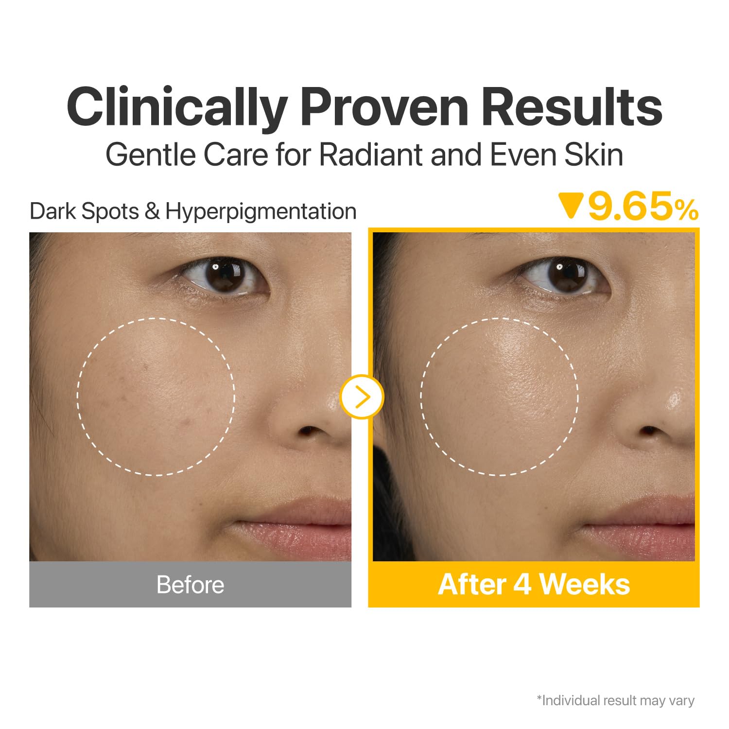 Numbuzin No.5 serum Glutathione and Vitamin C complex for even-toned glow.