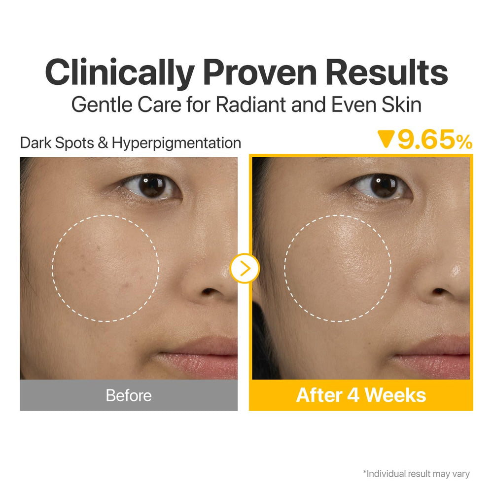 Numbuzin No.5 serum Glutathione and Vitamin C complex for even-toned glow.