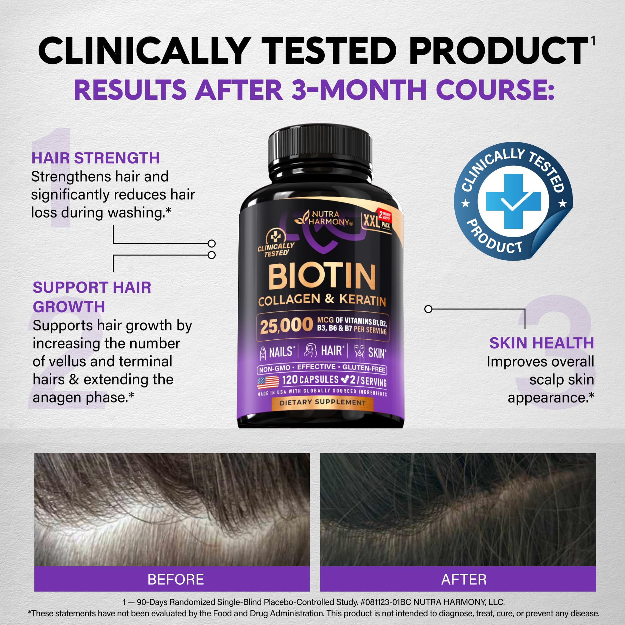 before and after hair photo demonstrating nutraharmony support for fuller-looking hair
