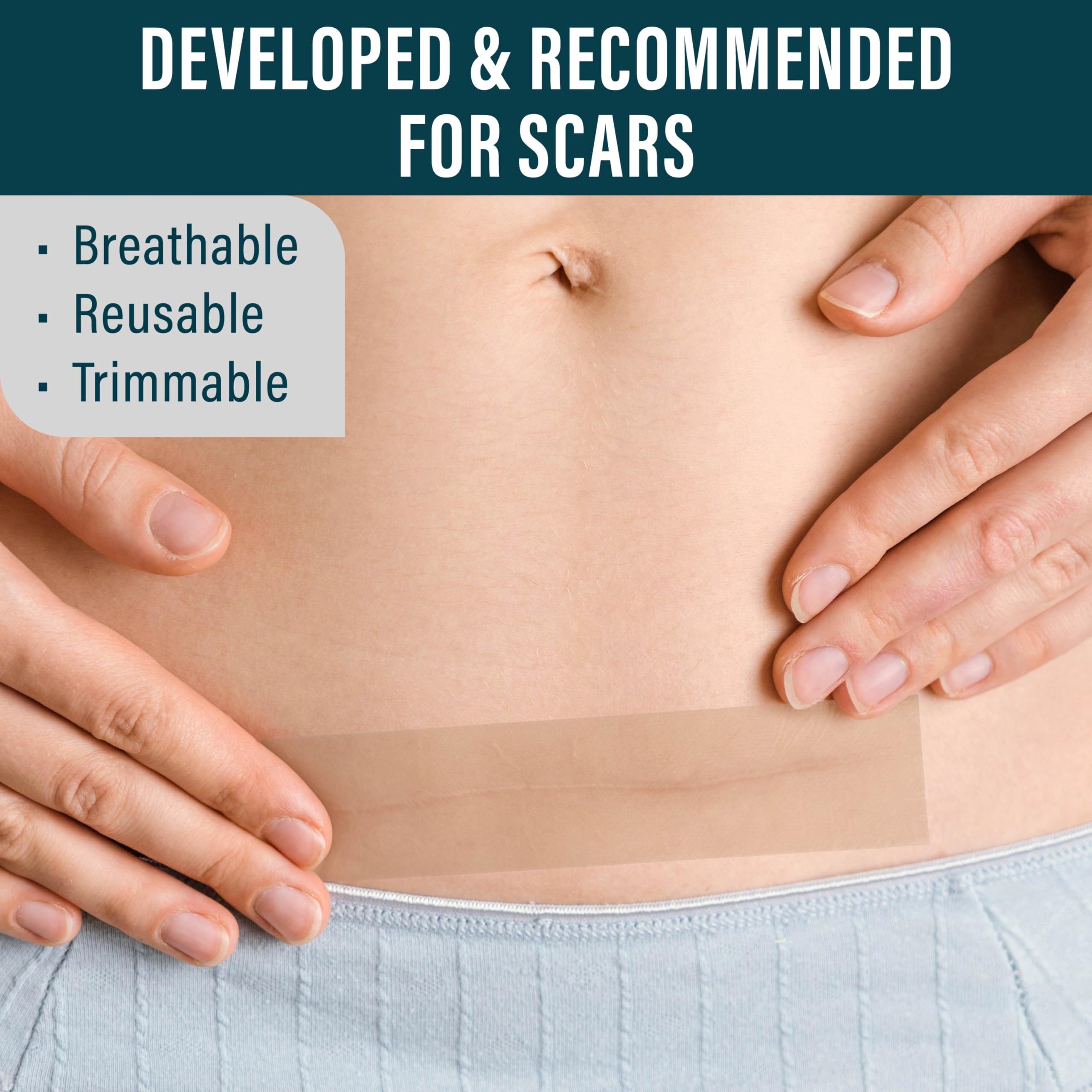 NUVADERMIS silicone scar tape on skin application demonstrates easy cut-to-fit sizing for scars.