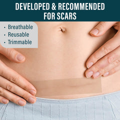 NUVADERMIS silicone scar tape on skin application demonstrates easy cut-to-fit sizing for scars.