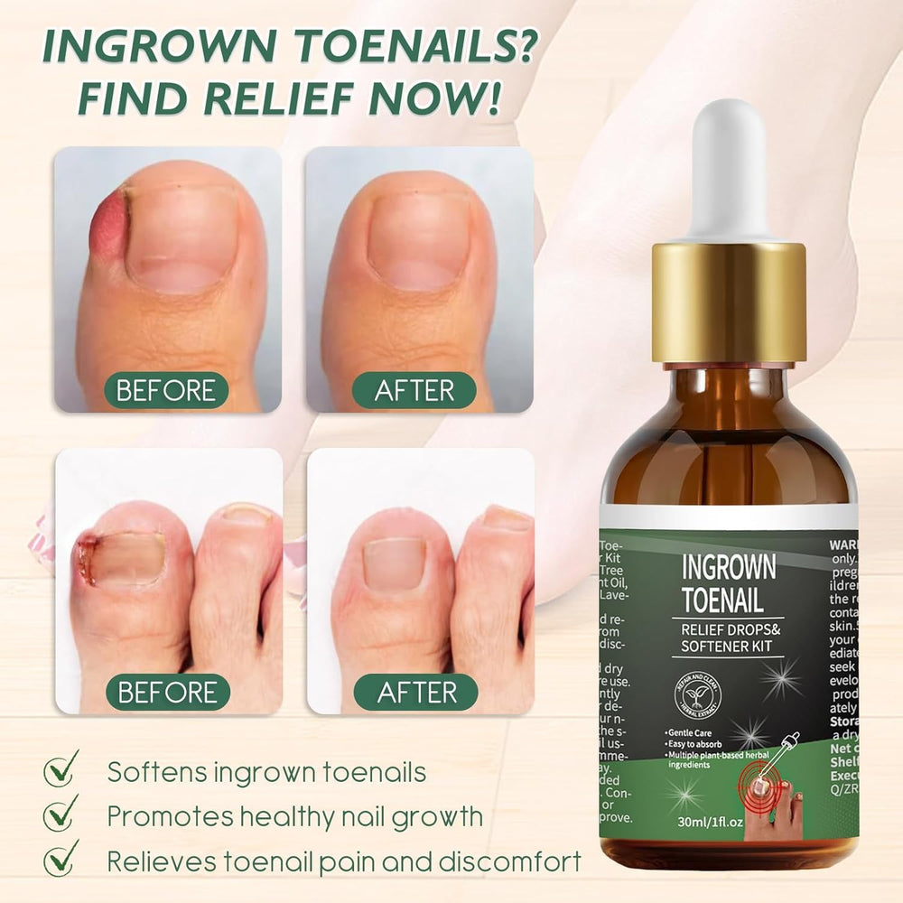 NWAKRD stainless steel tool for at-home toenail care