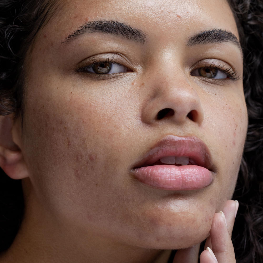 Obagi CLENZIderm skin-texture-improvement suggests smoother skin after use