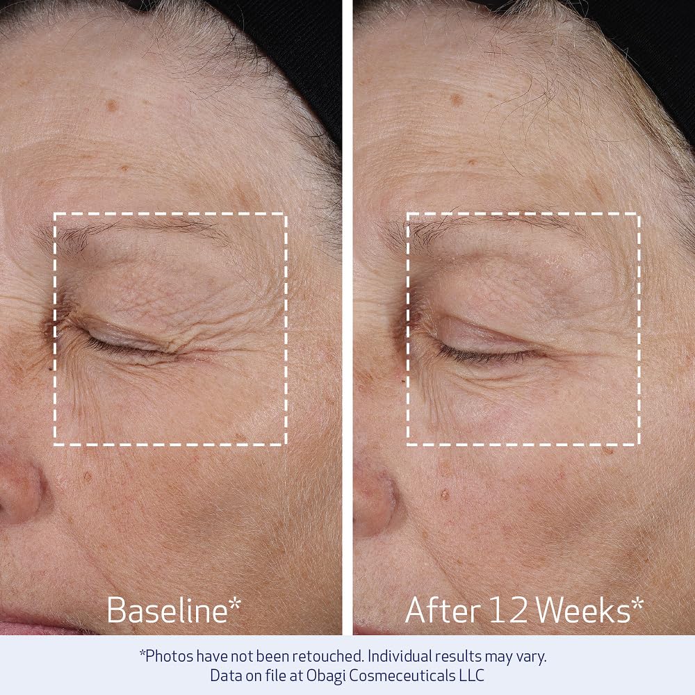 Obagi ELASTIderm bi mineral contour complex image highlighting zinc copper and malonic acid
