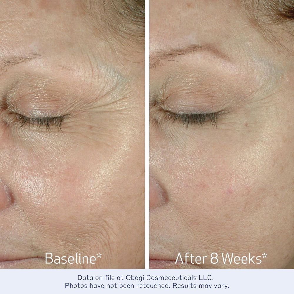 Obagi ELASTIderm Eye Cream tube application demonstrates gentle dab.