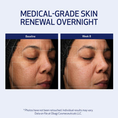 Obagi Medical Retinol + PHA Refining Night Cream application swatch shows creamy texture for easy spreading