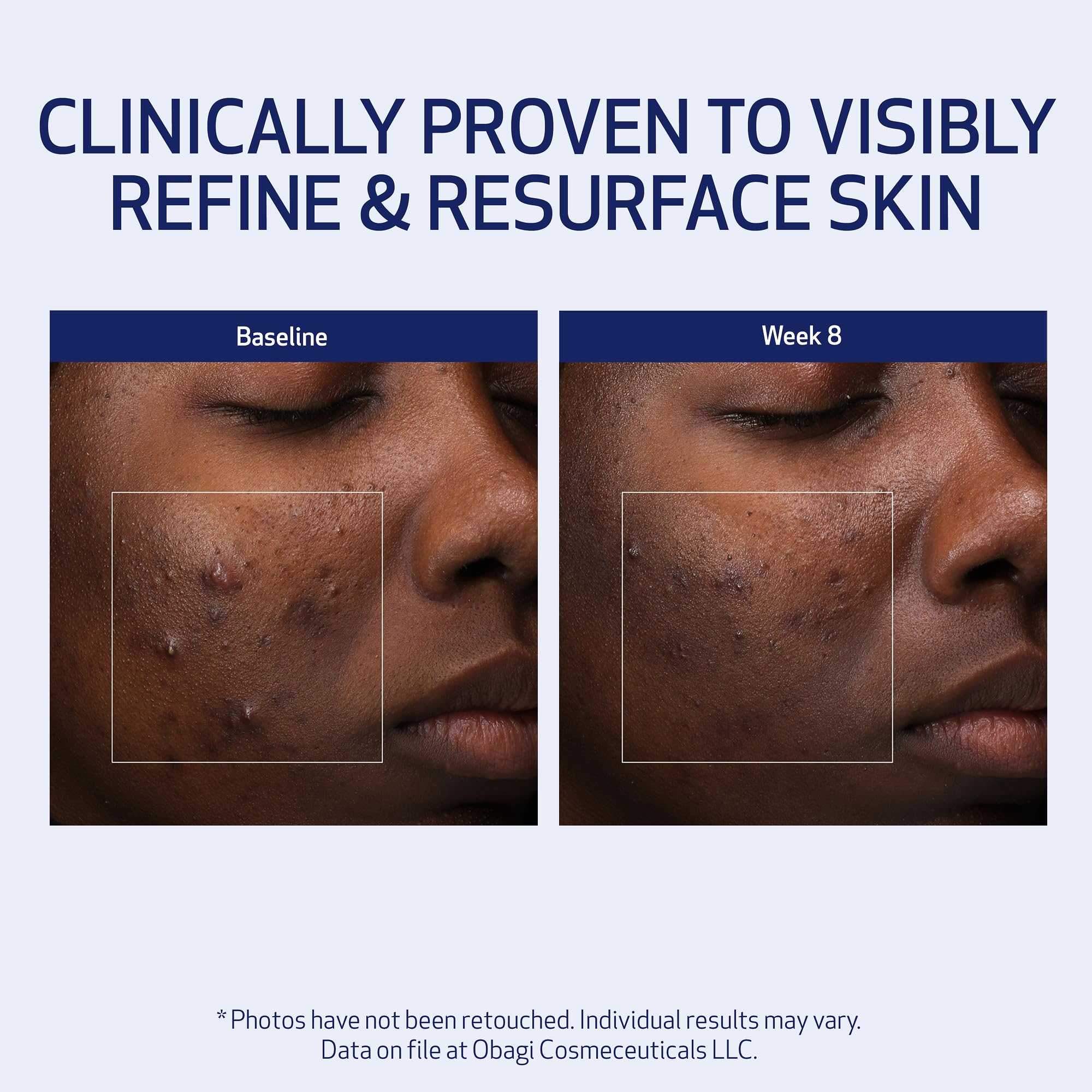 Obagi Medical Retinol + PHA Refining Night Cream packaging and box communicates premium branding