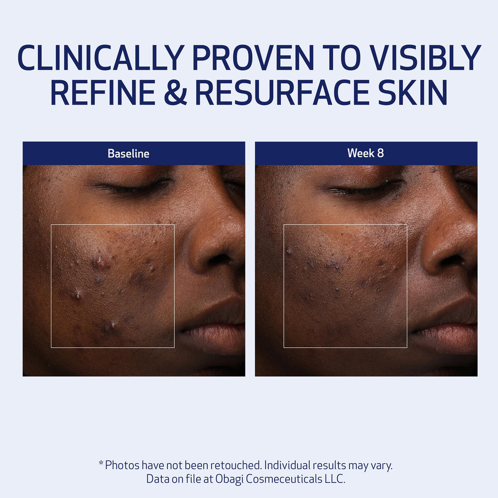 Obagi Medical Retinol + PHA Refining Night Cream packaging and box communicates premium branding