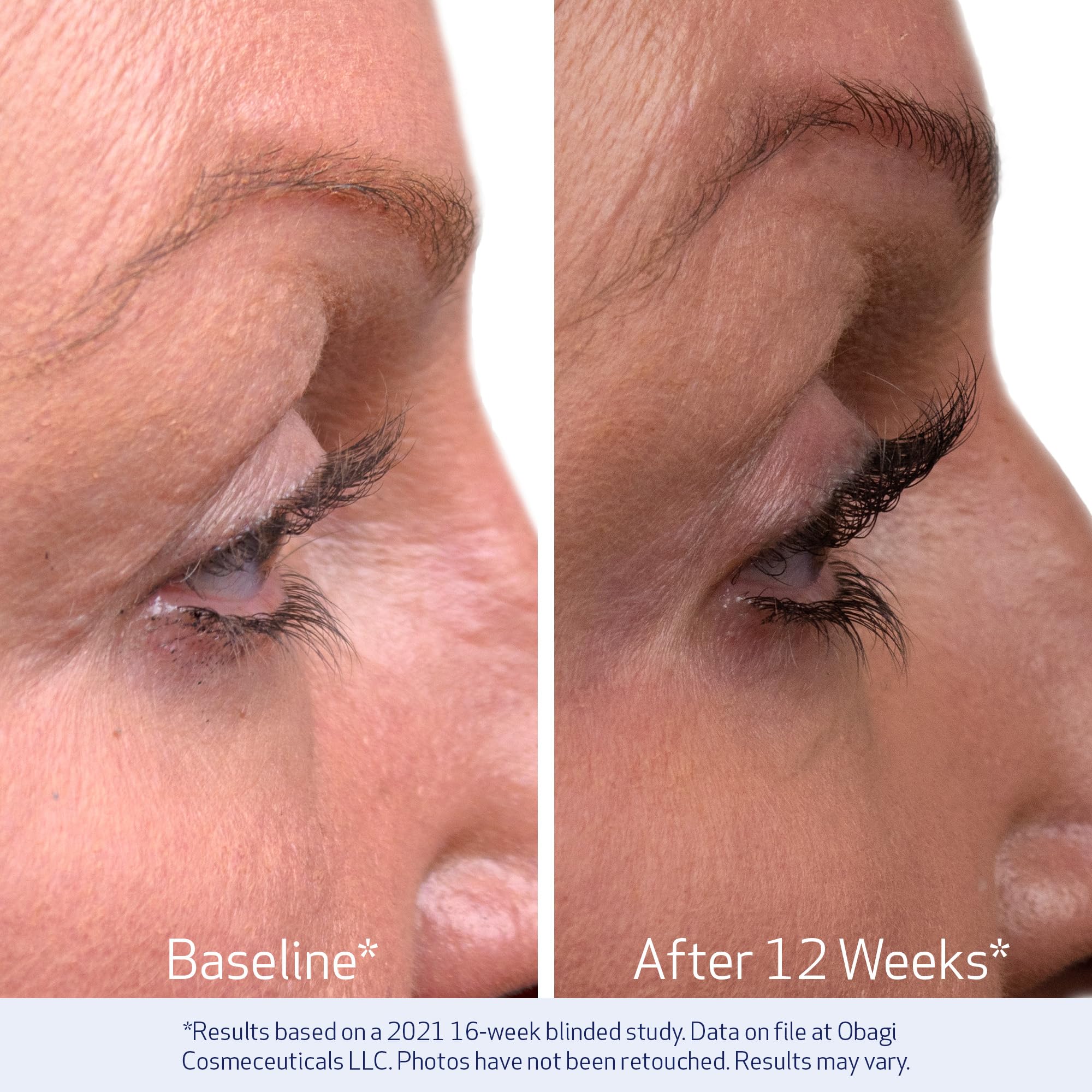 Obagi Nu-Cil serum ingredients palette emphasizes Biotin and Hyaluronic benefits for lashes.
