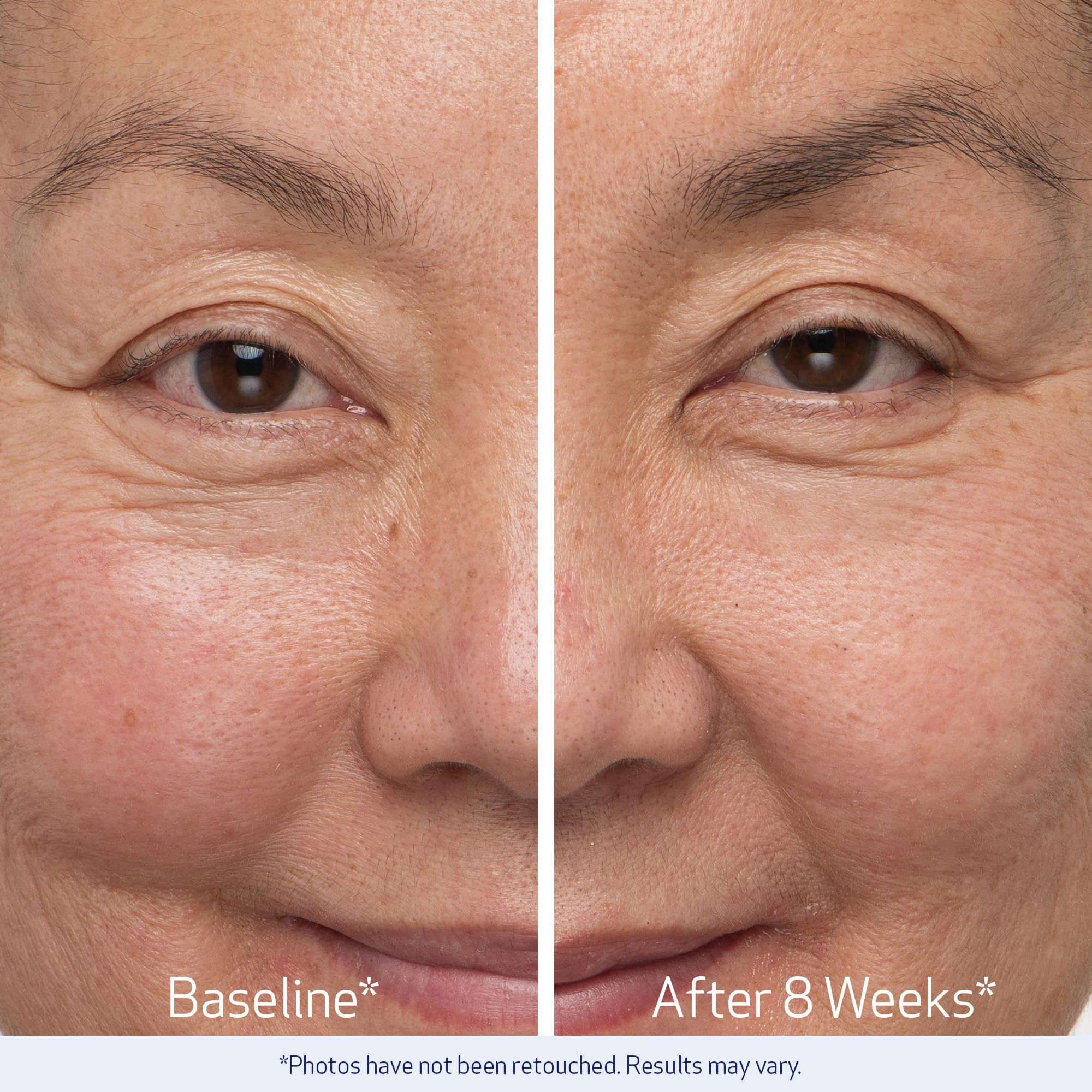 Obagi Nu-Cil study results graphic highlighting eight and twelve week outcomes.