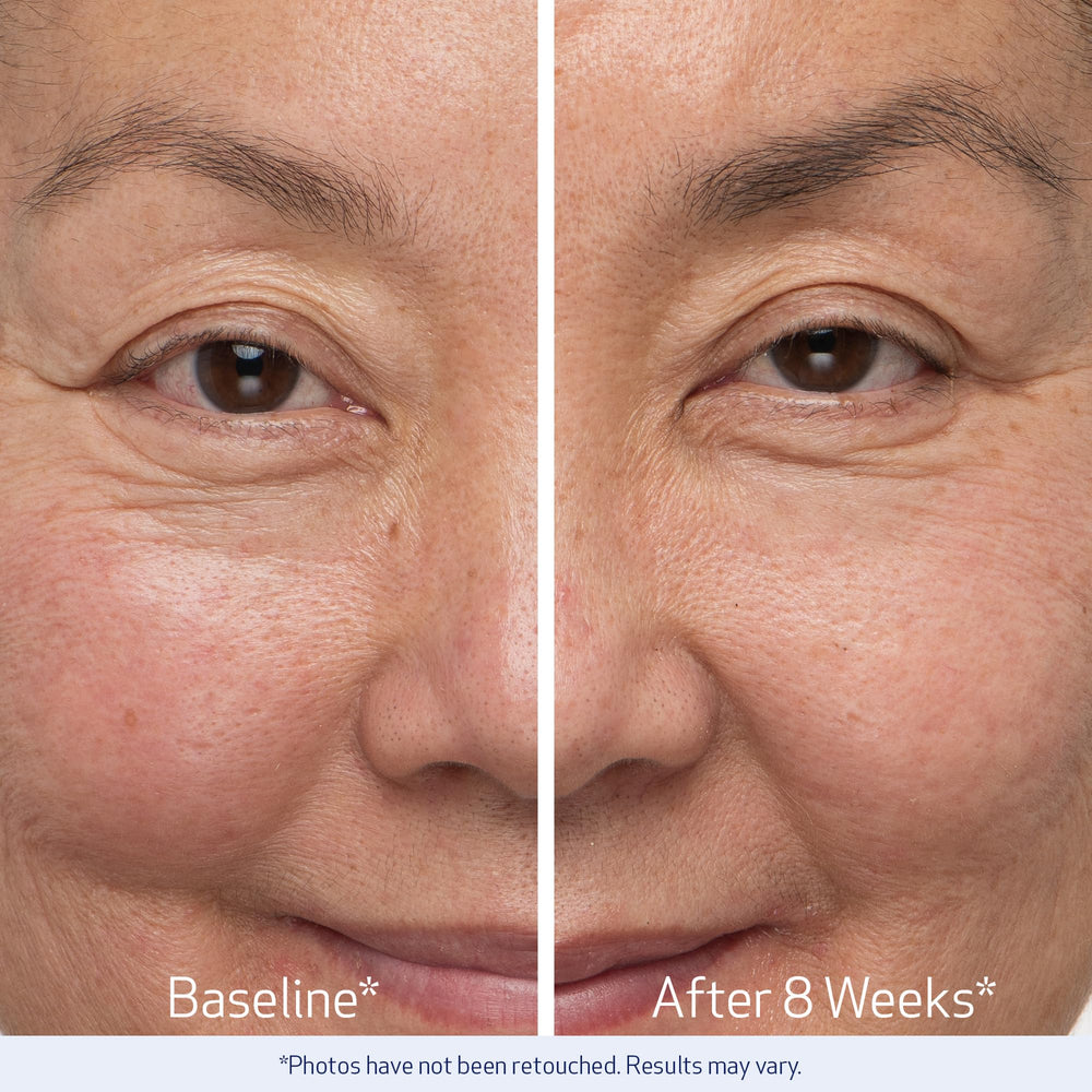 Obagi Nu-Cil study results graphic highlighting eight and twelve week outcomes.